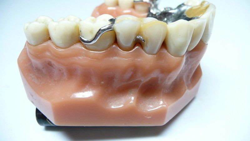 View of a denture