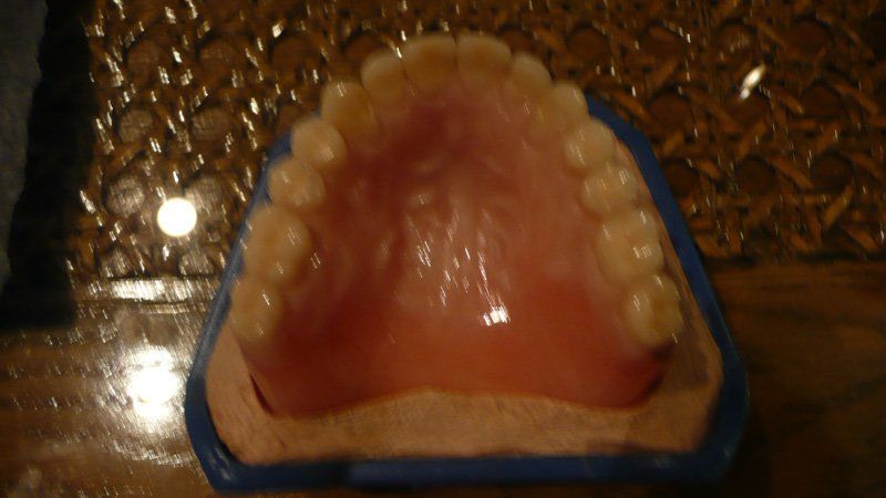 View of a denture