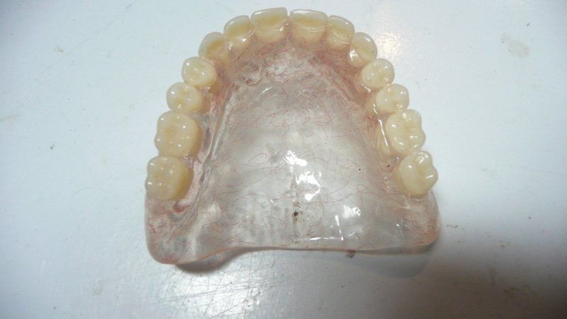 View of a denture
