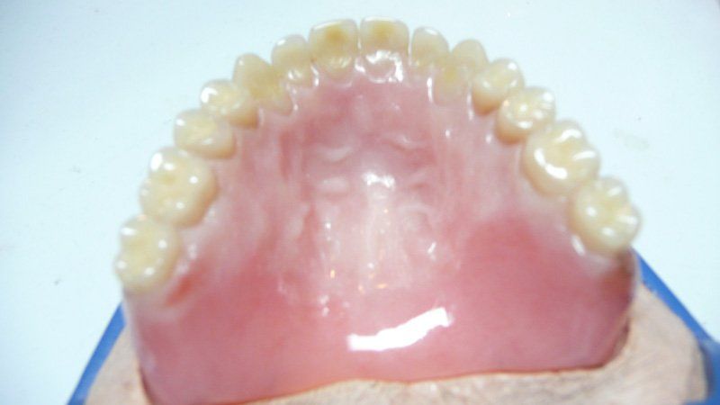 View of a denture