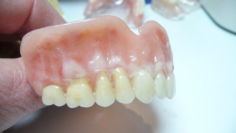View of a denture