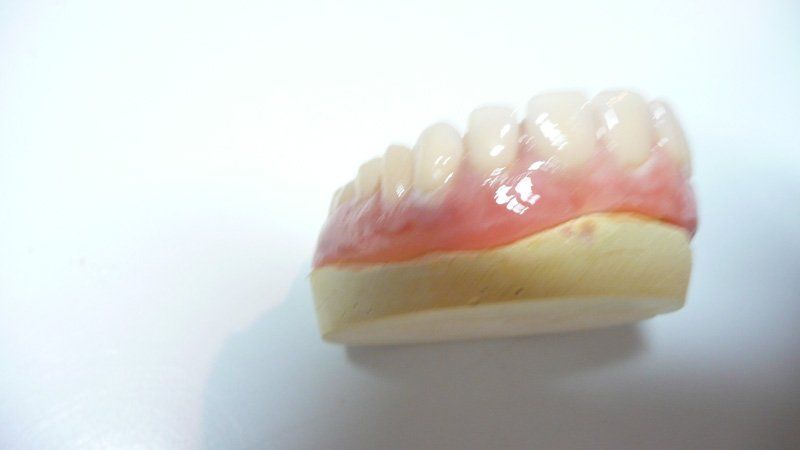 Side view of a denture