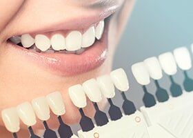 White Teeth of a Woman — Preventative Care in Lake Charles, LA