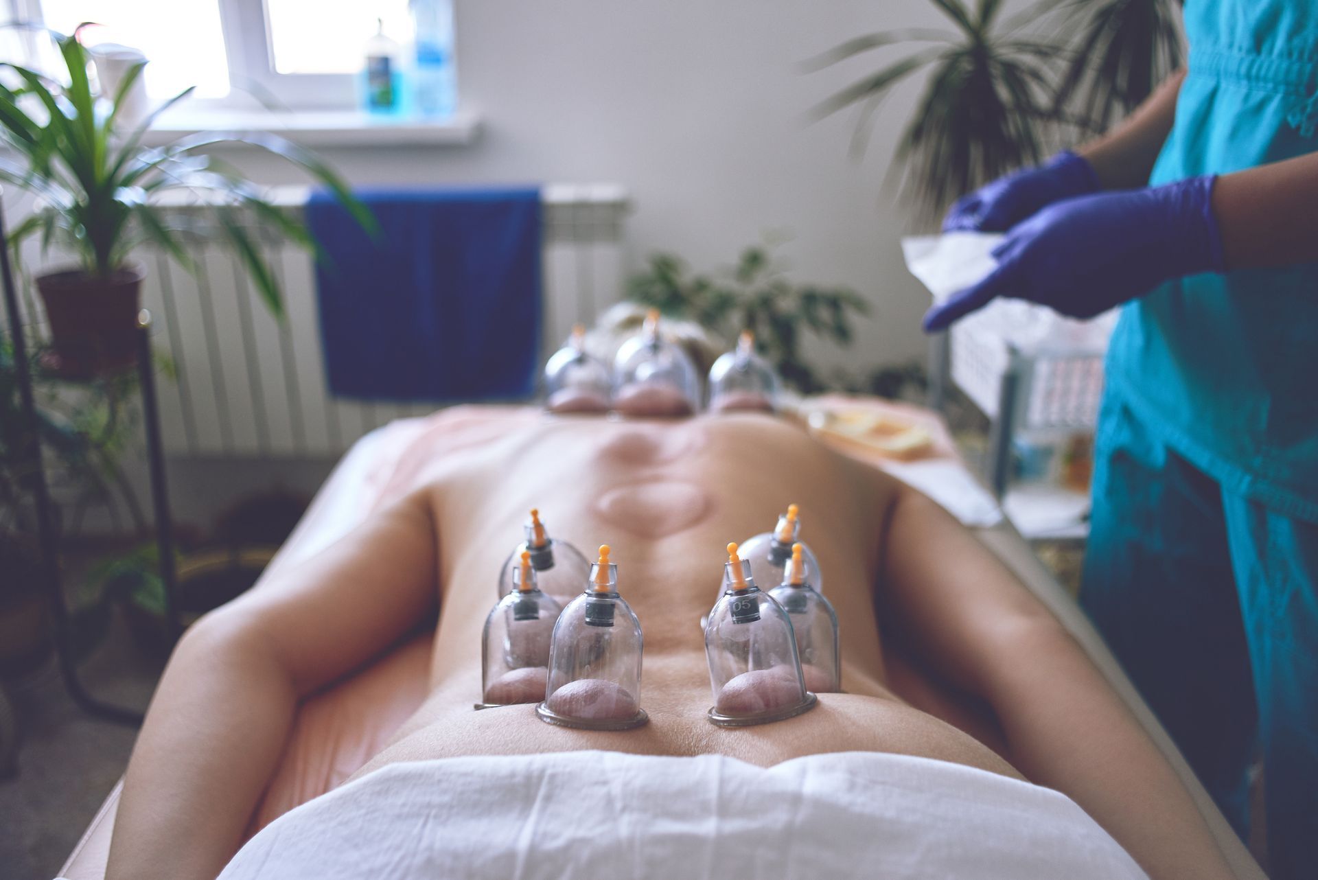 A patient lying on a treatment table receiving cupping therapy on their back, administered by a medical practitioner.