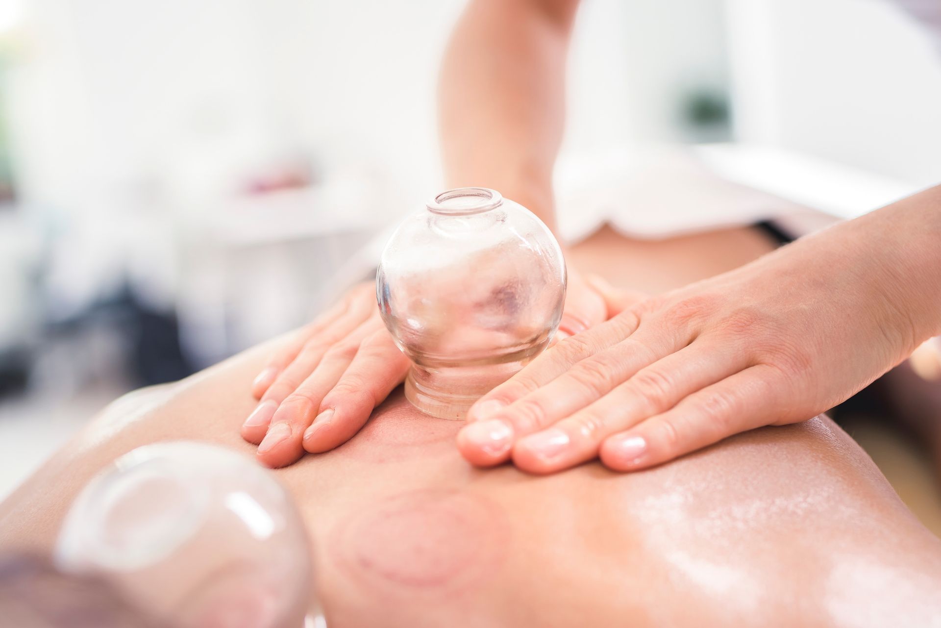 A therapist performs a cupping therapy treatment on a person's back using clear glass cups and massage oil.