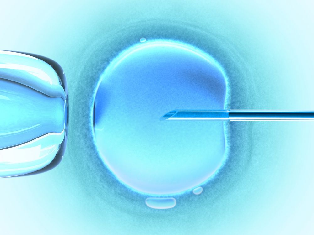 FIV (Fertilização in vitro)