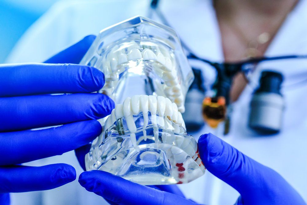 Teeth Model — Lutz, FL — Dr. William J Geyer Dr. Leslie Hernandez