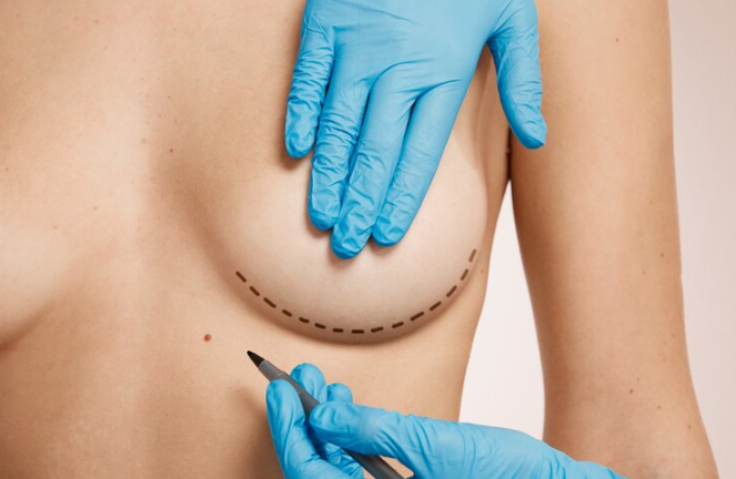 Qual médico e especialista em mamoplastia redutora Qual medico e especialista em mamoplastia redutora