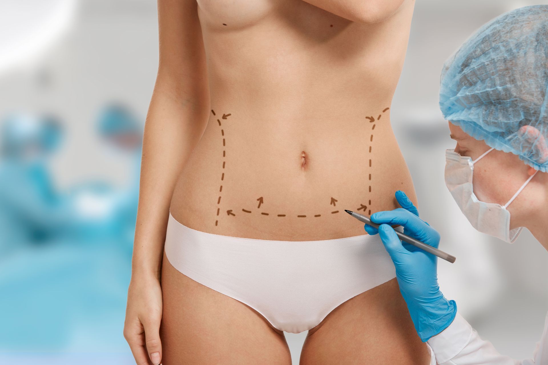 Como funciona a recuperacao da lipoabdominoplastia minimamente invasiva MILA