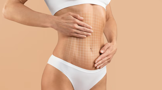 Qual o peso ideal para fazer a lipoabdominoplastia