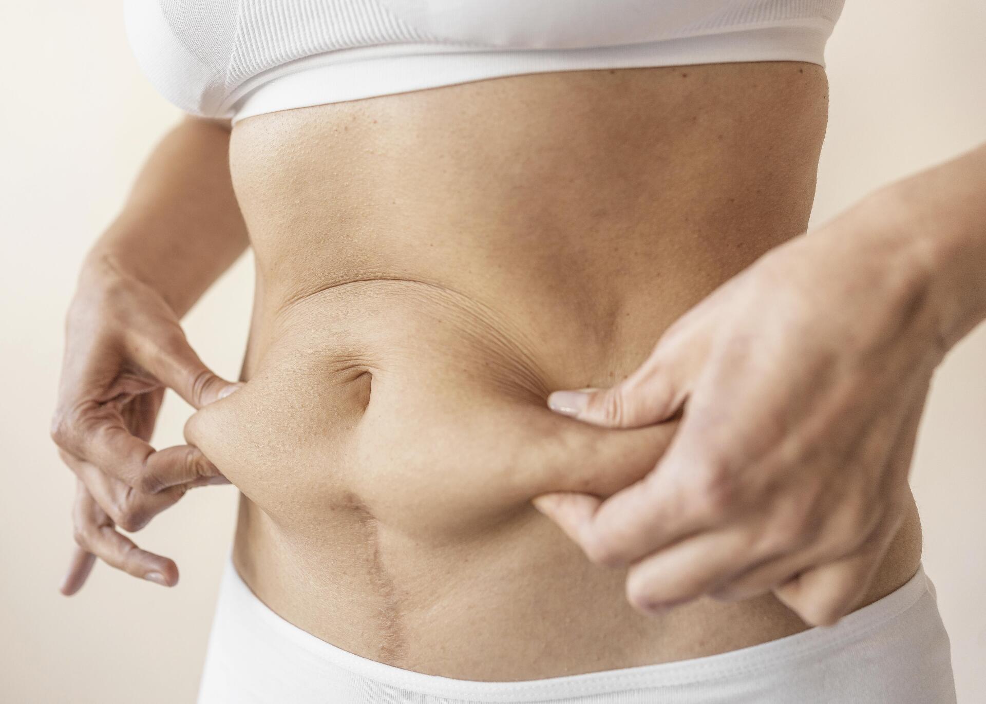 O que é a abdominoplastia?