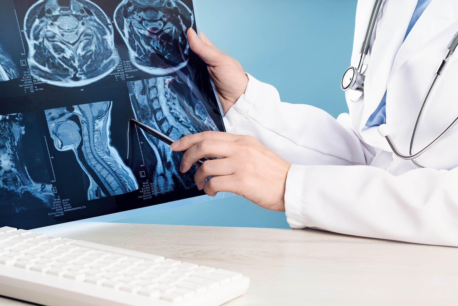 Doctor examining X-ray images with pen, wearing a white coat and stethoscope, sitting at a desk.