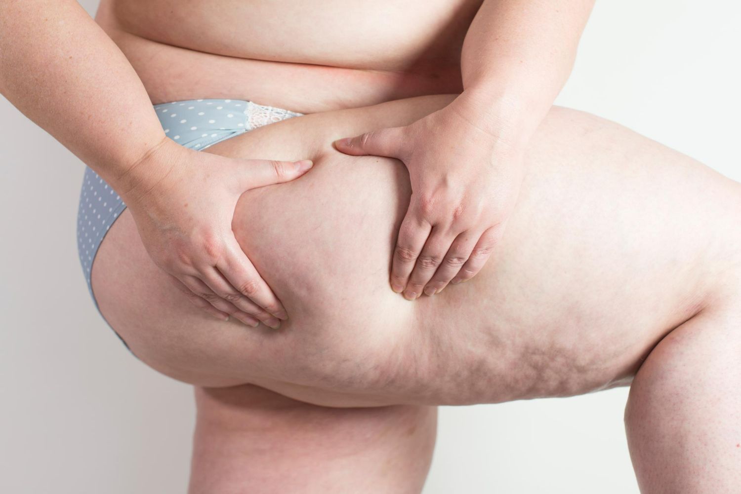 A woman is holding her thigh with her hands.