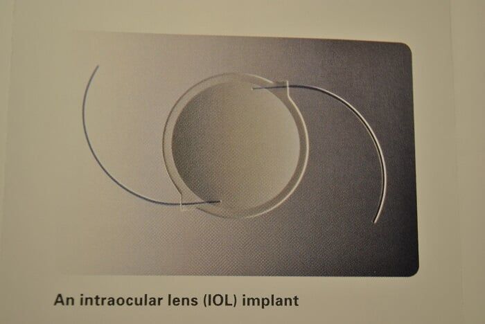 Find cataract facts at Altoona Ophthamology, Altoona, PA