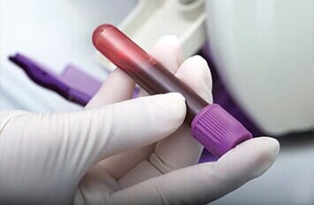Doctor holding sample of blood -  Drug testing in Highland, IN