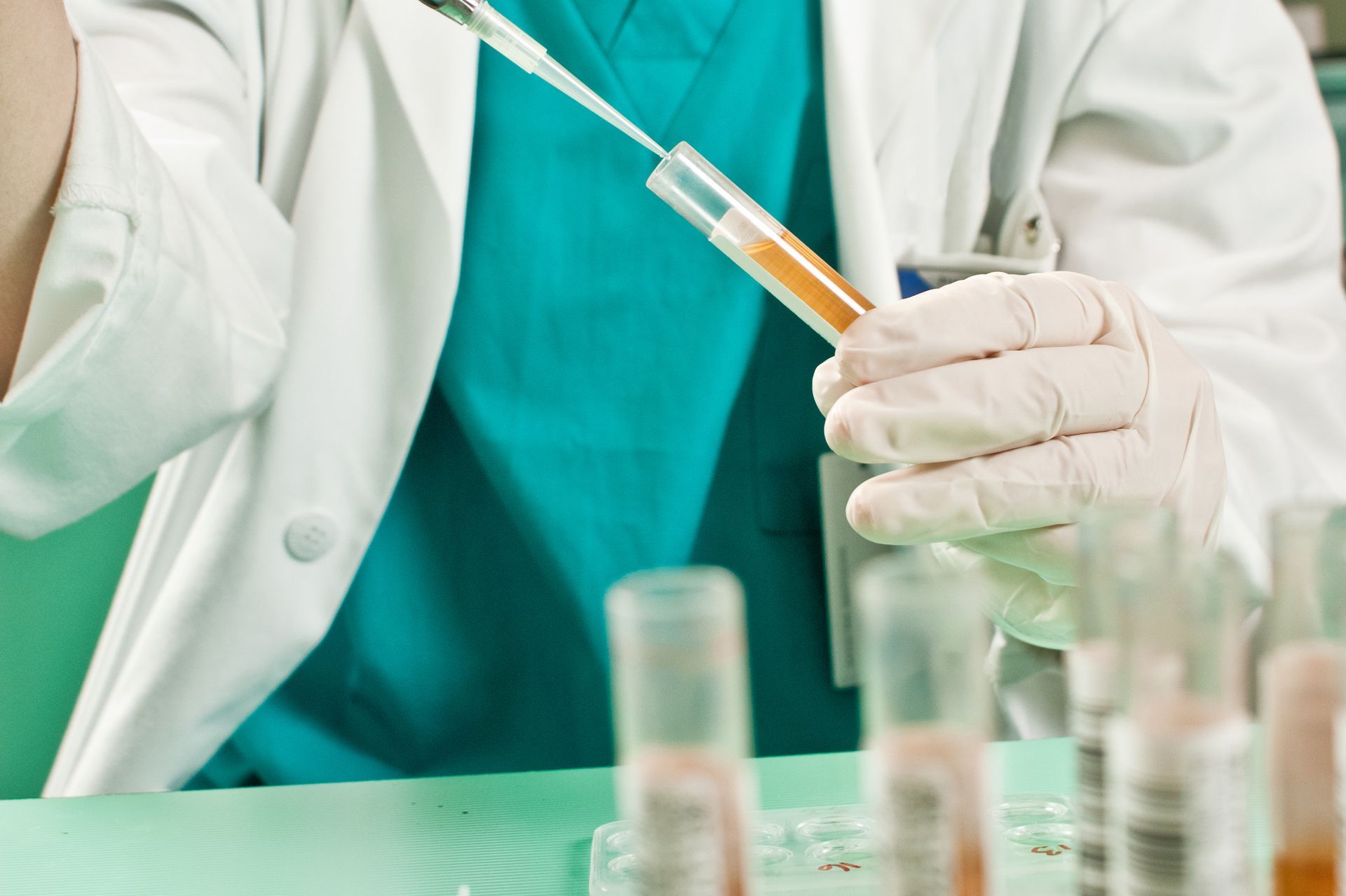 A healthcare worker with gloves handles a pipette of a urine sample for a drug test.