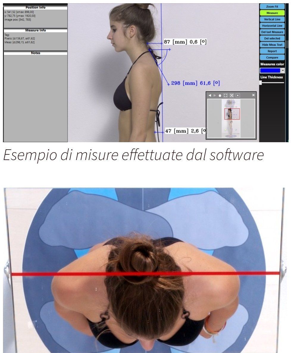 Osteopatia strutturale con analisi fotografica posturale a Giarre
