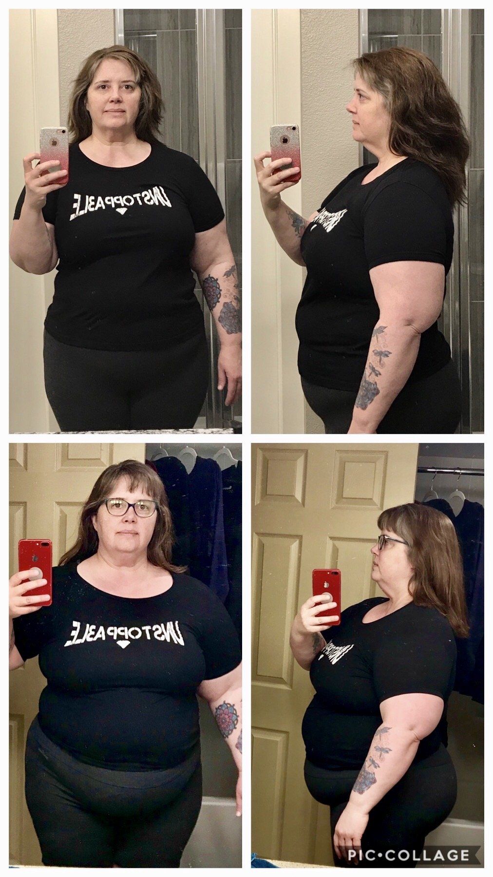 Before and 4 Months After Gastric Sleeve Photos