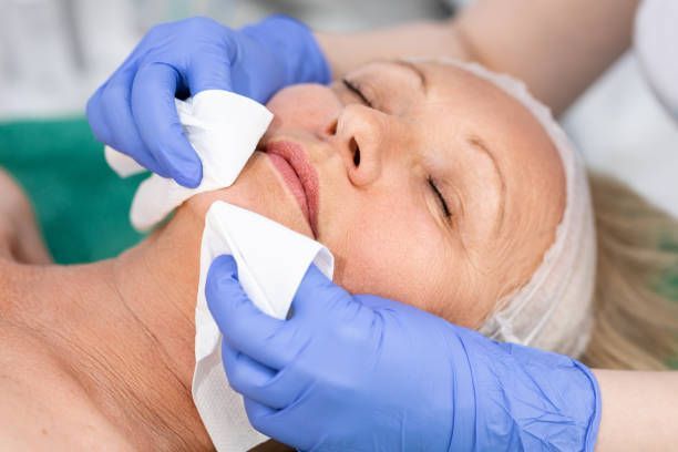 A woman having her face wiped with white cloths by gloved hands in a spa setting. She has her eyes closed.