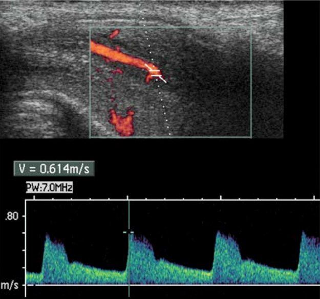 Misurazione stato di salute degli spermatozoi