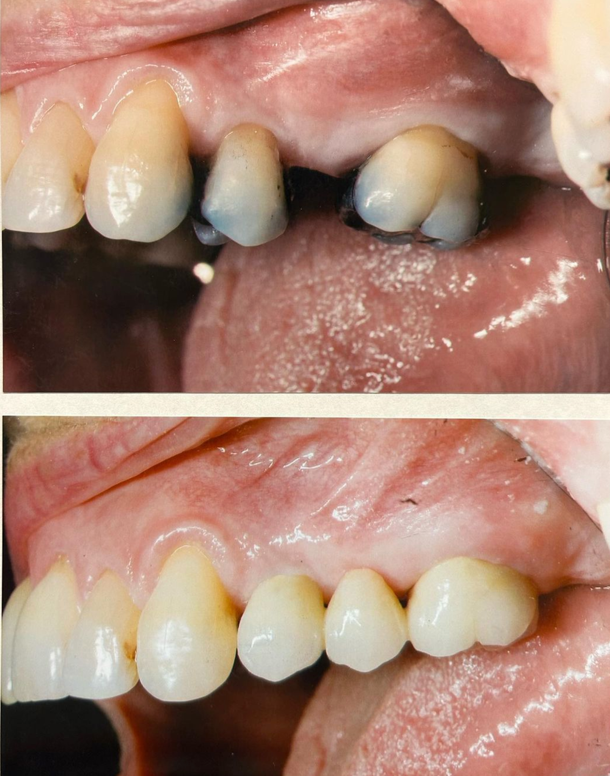Dental Care
