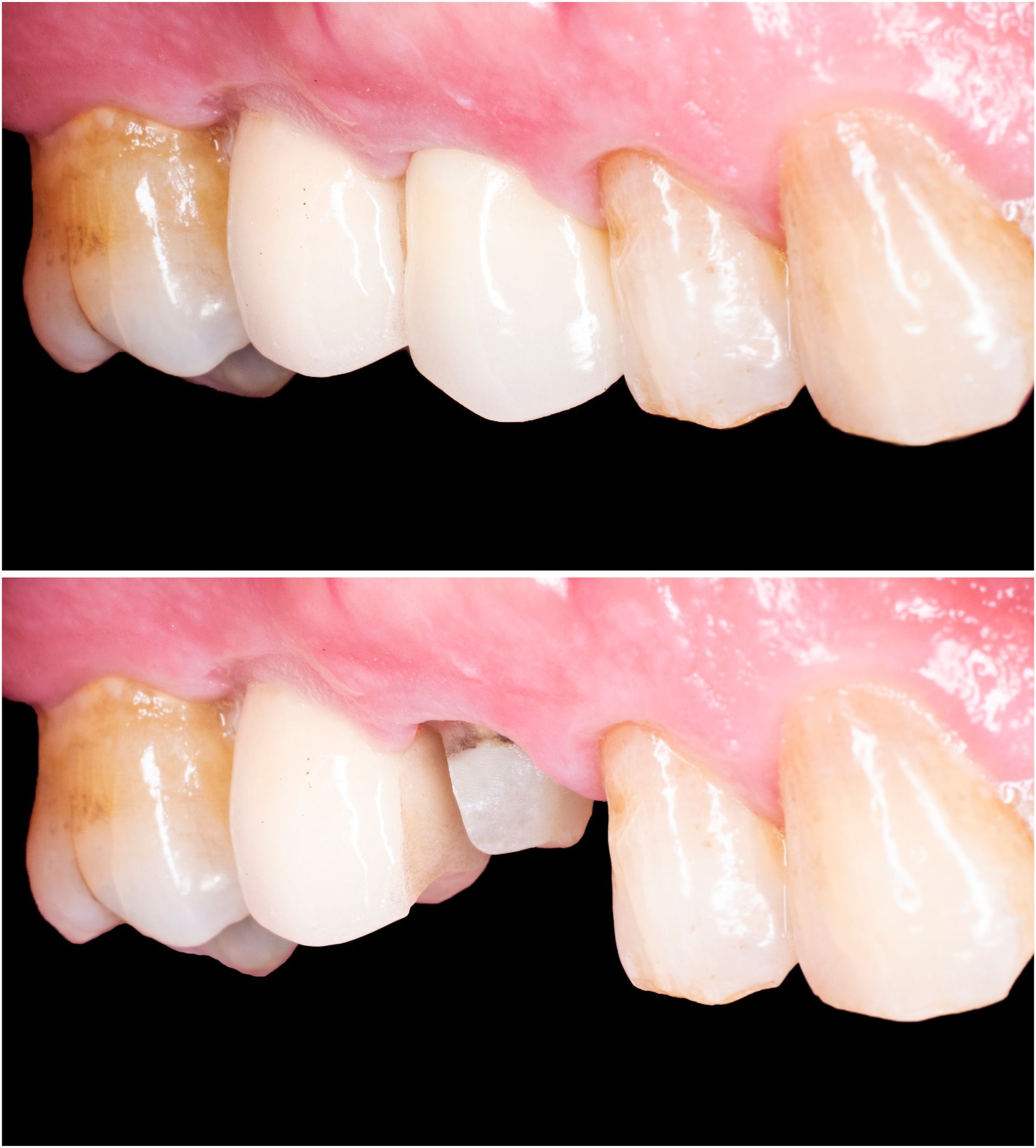 Dental Care