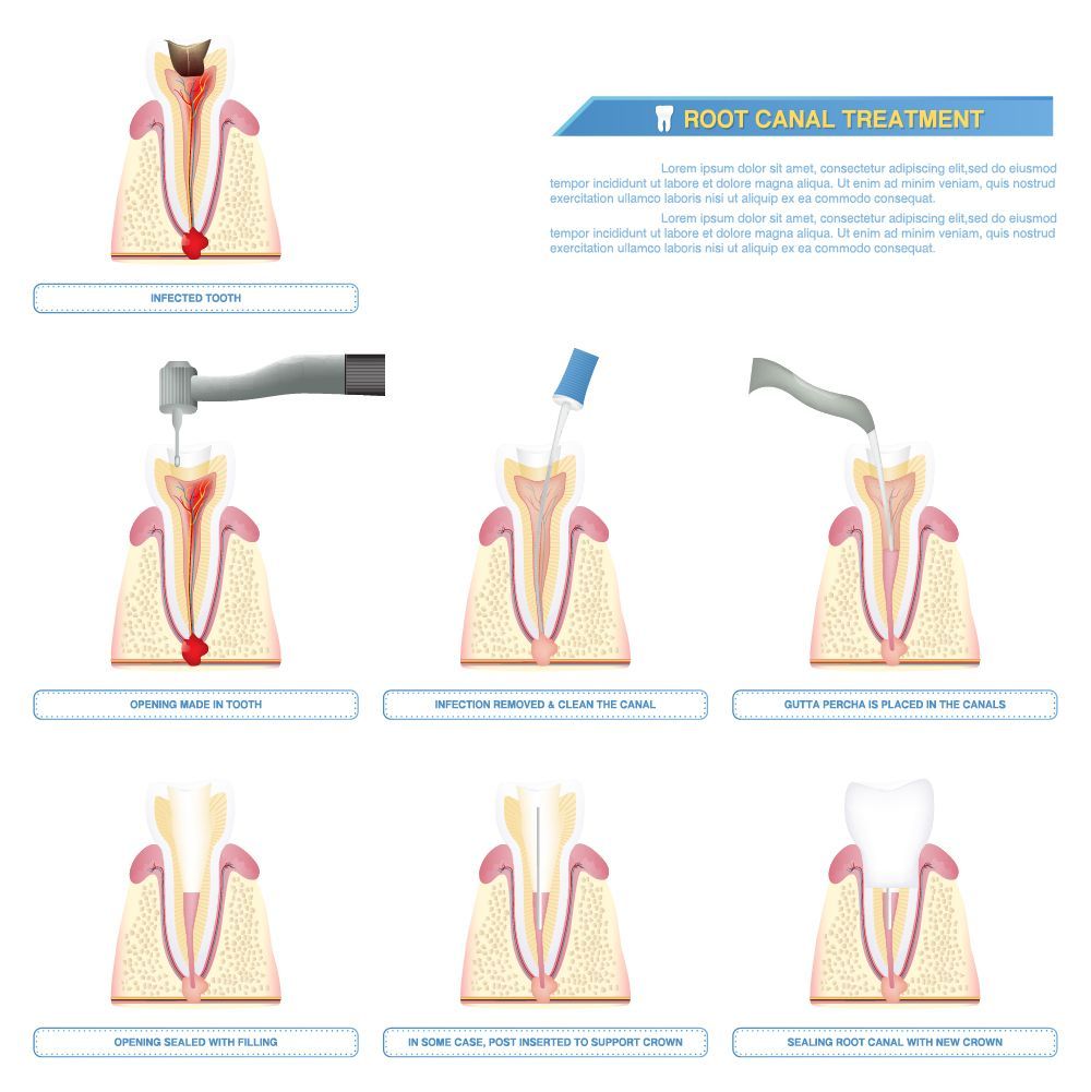 Dental Care
