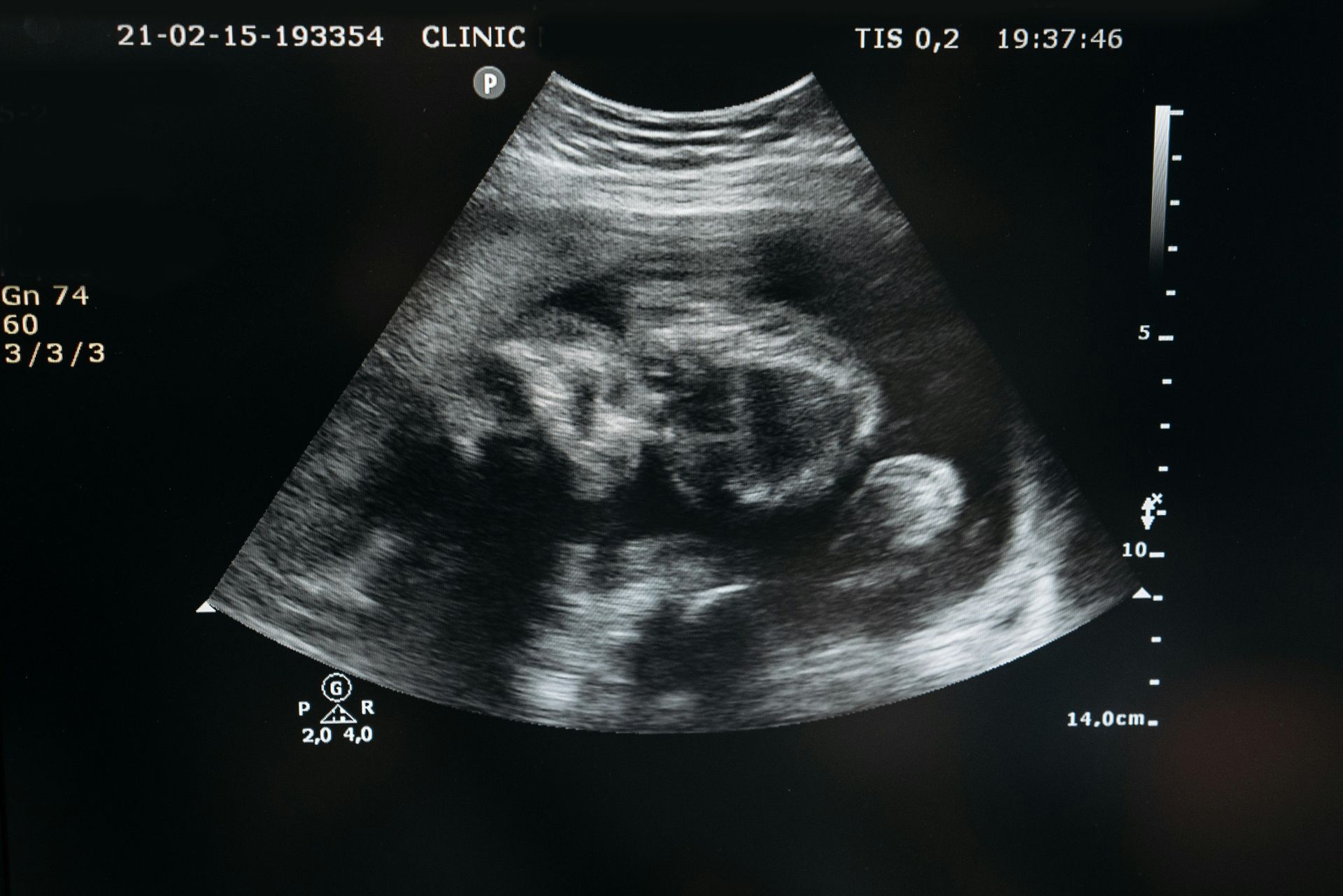 fetal development 