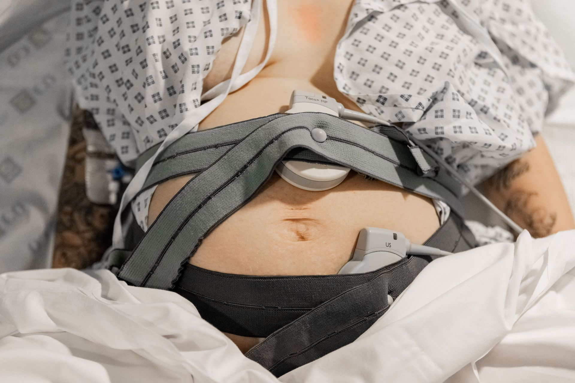 Una persona está acostada en una cama de hospital con un cinturón alrededor del estómago.