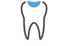 Endodonzia dentista