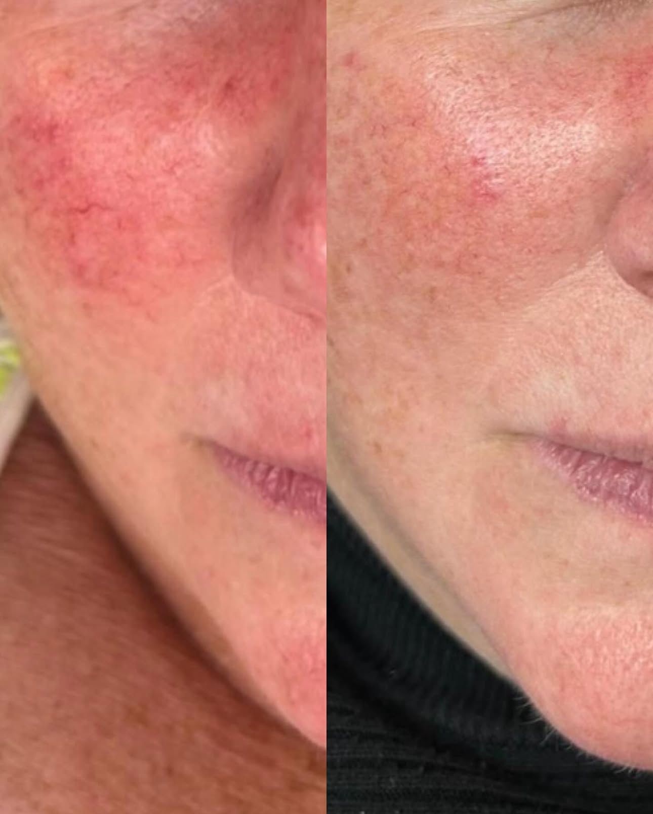 Woman's Face and Shoulders, Hands Touching Her Cheek, Soft Skin, Light Background — Eternal Radiance in Strathmore, VIC