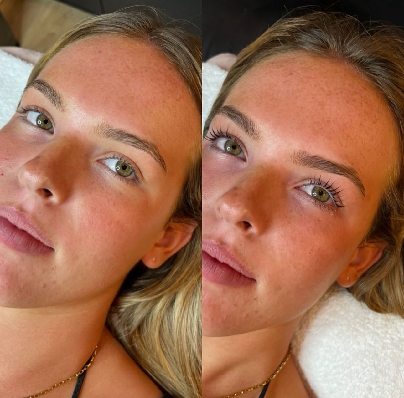 Woman Receiving an Eyebrow Treatment in a Salon — Eternal Radiance in Strathmore, VIC