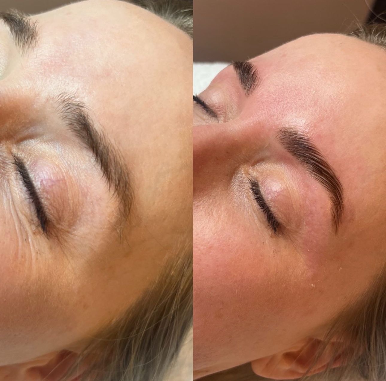 Blonde Woman With Light Skin Smiling, Looking at Camera, Outdoors With Sunlight — Eternal Radiance in Strathmore, VIC