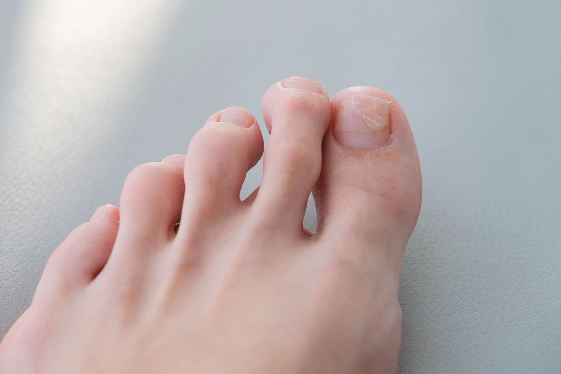 Close-up of a human foot with five toes on a gray surface. The toenails appear to be unpolished.