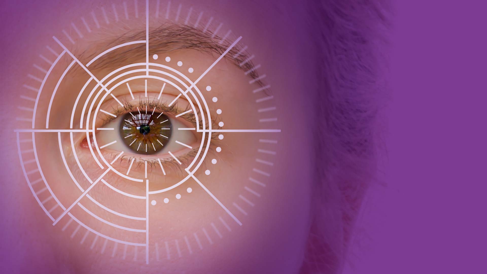 Iridology Services