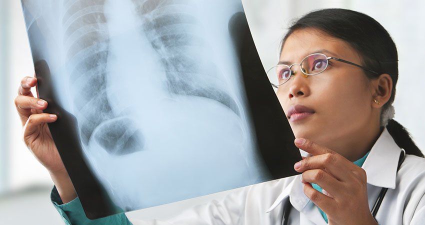 doctor looks at x-ray
