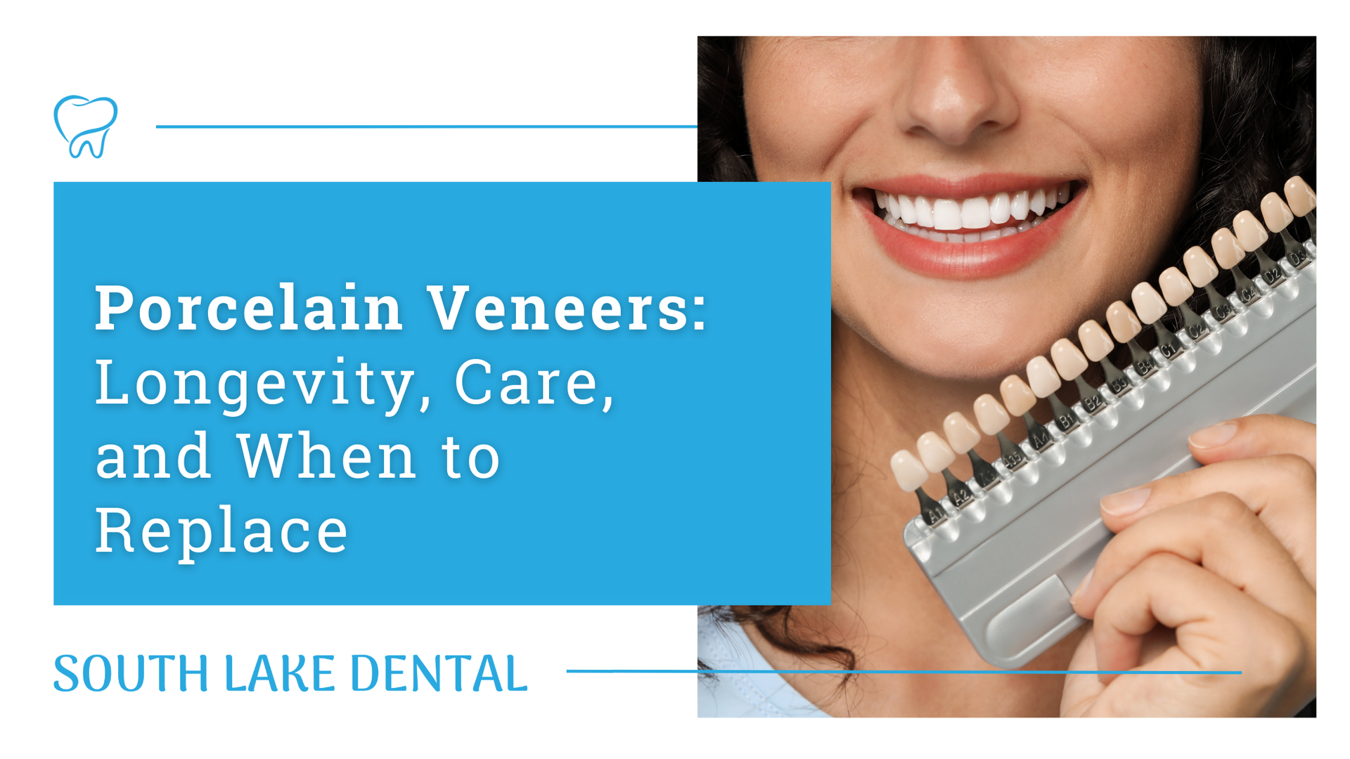 Porcelain veneers : longevity , care , and when to replace south lake dental