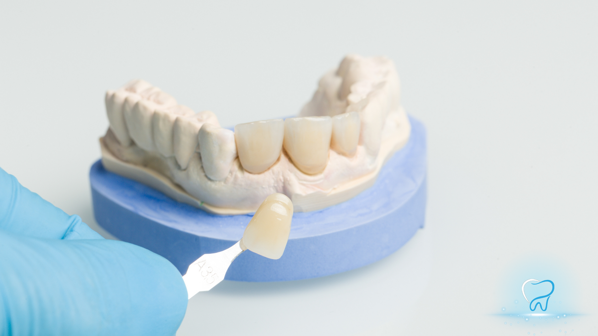 Dentist holds a tooth shade guide next to a dental mold with ceramic crowns.