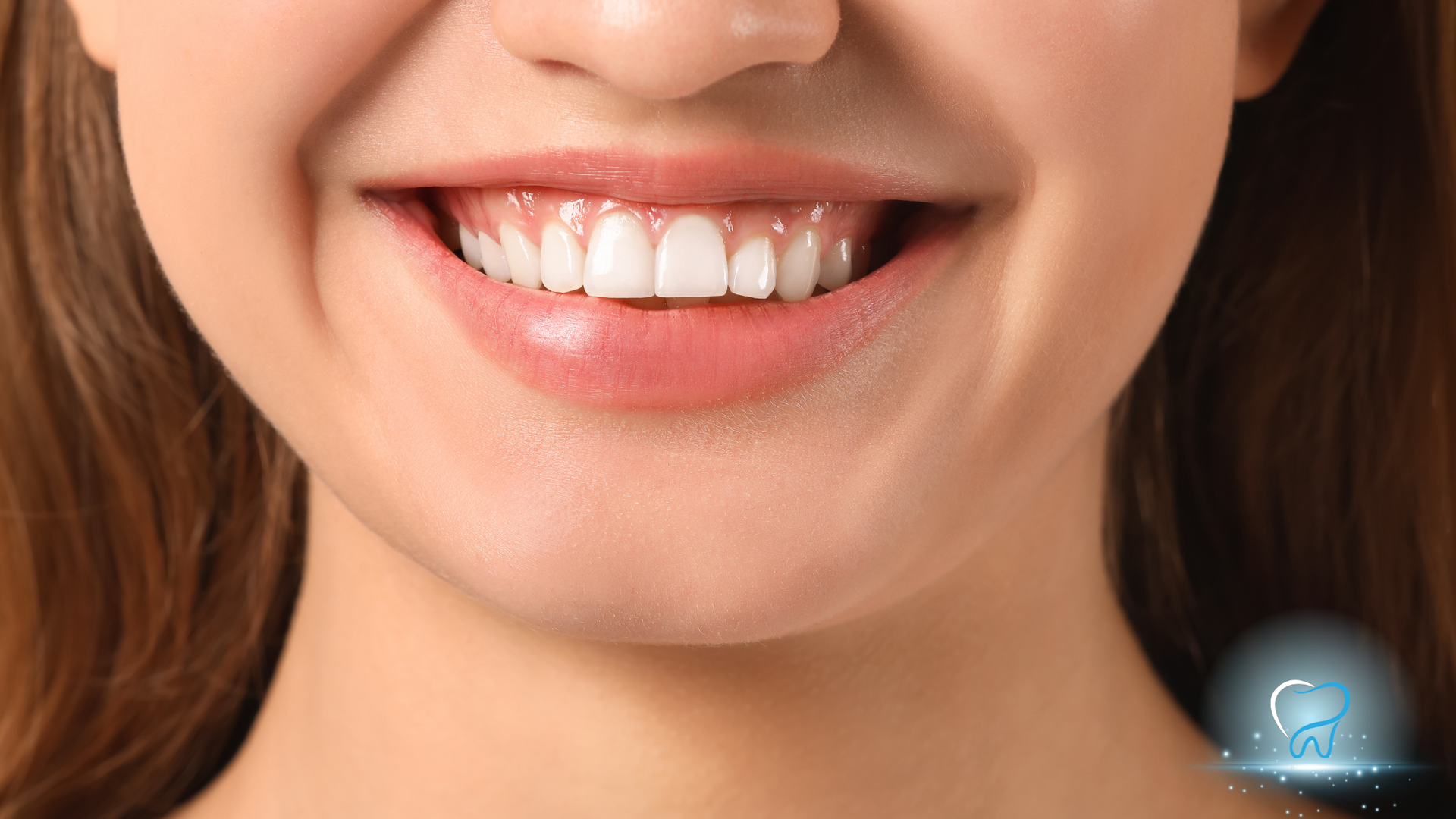 A close up of a woman 's smile with white teeth.