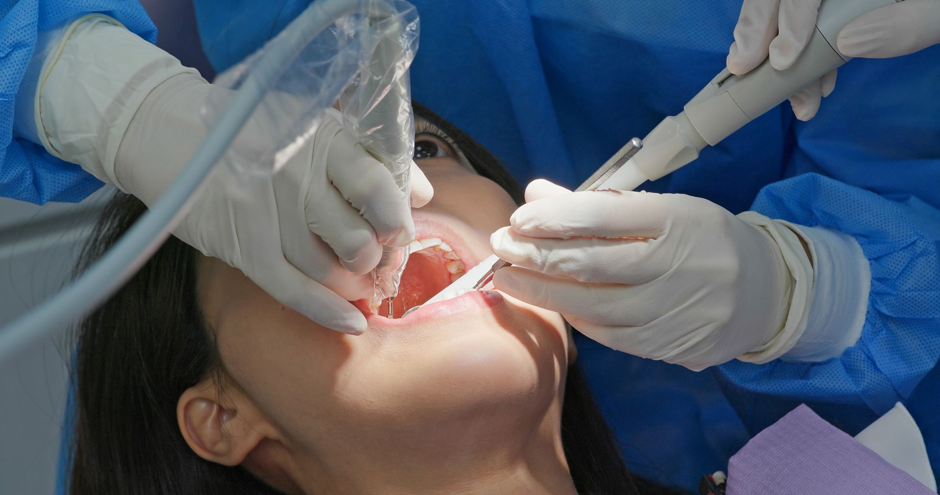 Dentist and assistants treating a patient’s open mouth in a dental clinic, using tools and a light.