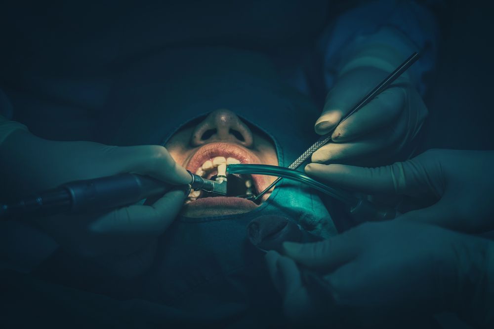 operazioni ai denti ravenna