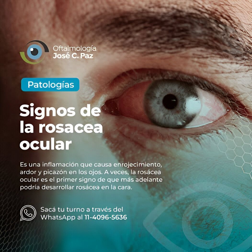 Primer plano de un ojo rojo e irritado.
