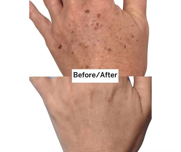 A before and after photo of a person 's hand