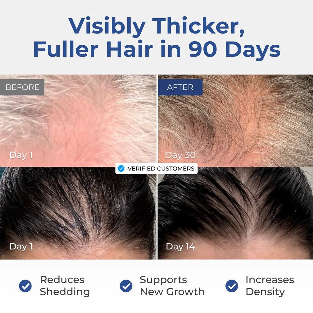 ghk-cu hair growth Advanced GHK-CU + AHK-CU main image 1