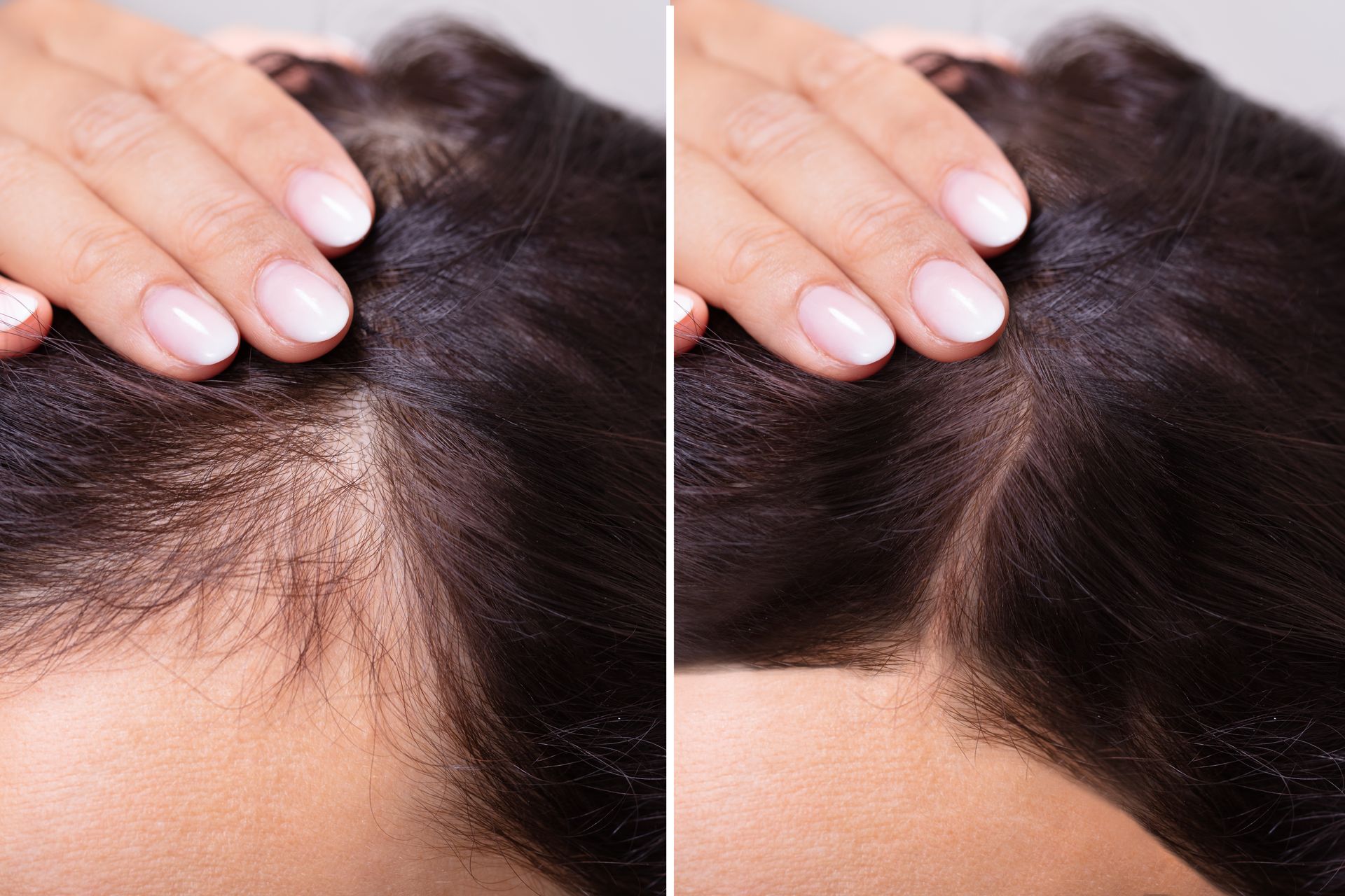 Two images show hair loss before (left) and after (right) treatment, with hands touching the scalp.