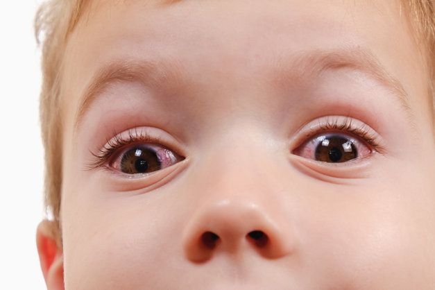A close up of a baby 's eyes on a white background.