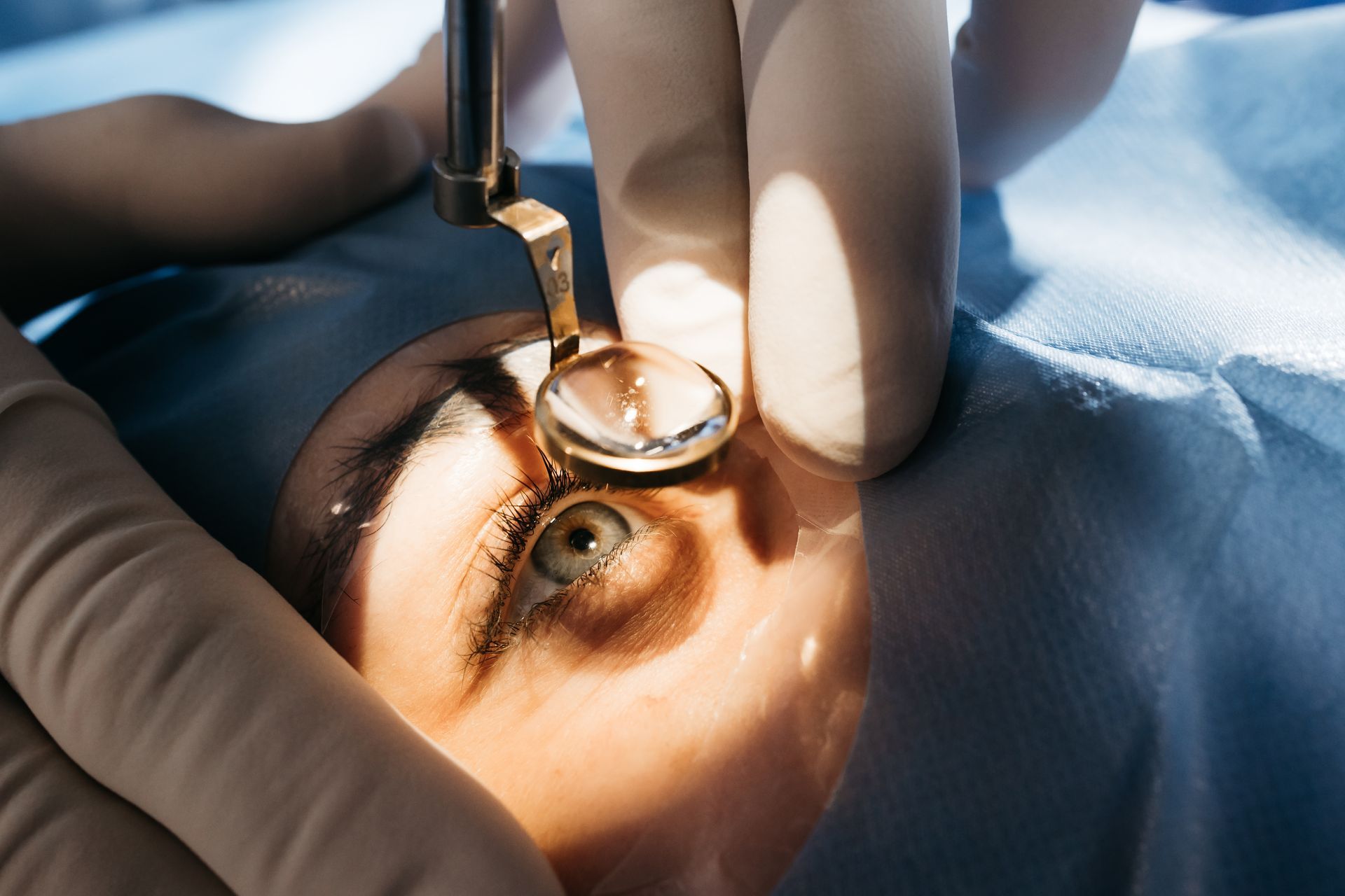 Gloved hands holding a small instrument near an eye during a medical procedure