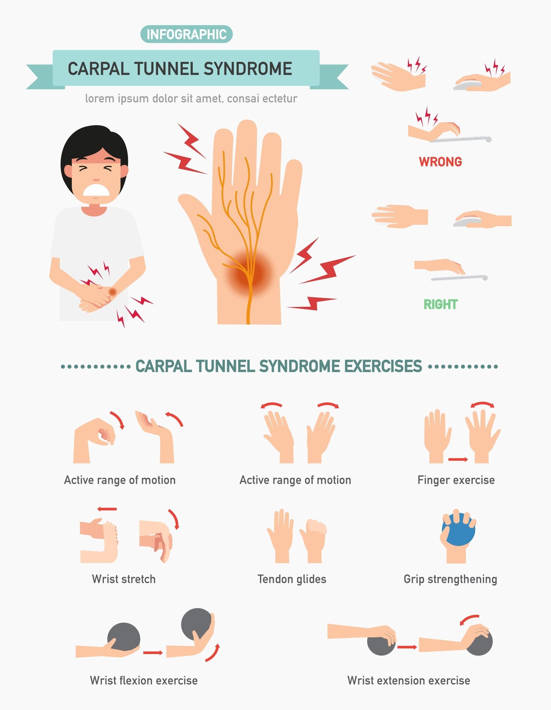 Carpal tunnel syndrome exercises