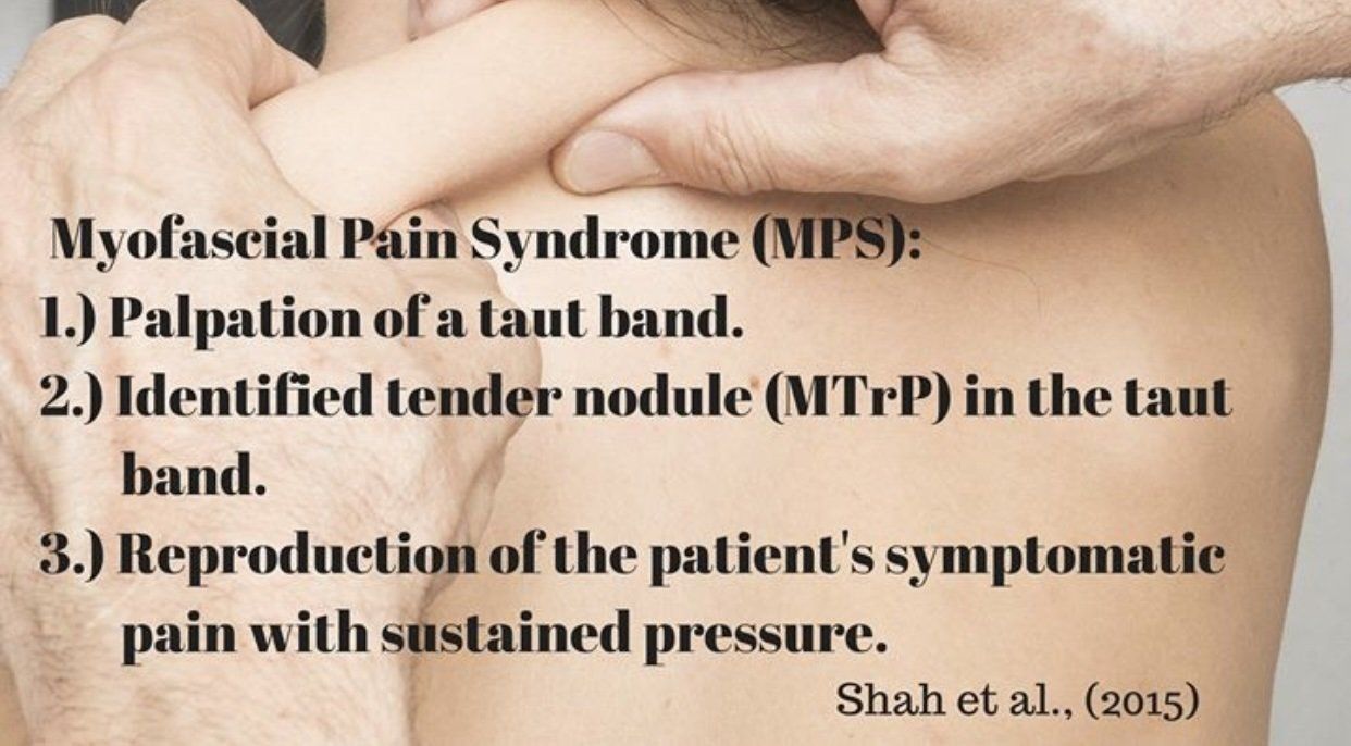 myofascial pain syndrome