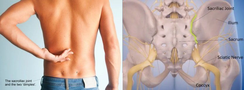 sacroiliac joint and lower back pain
